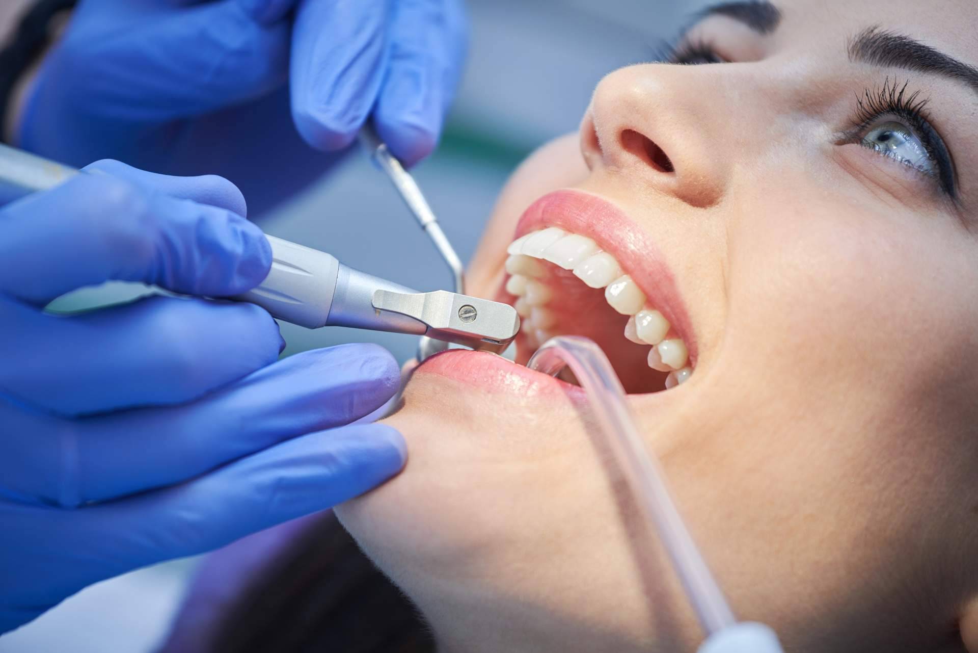 La importancia de las limpiezas dentales profesionales, por Helident Clínica Dental