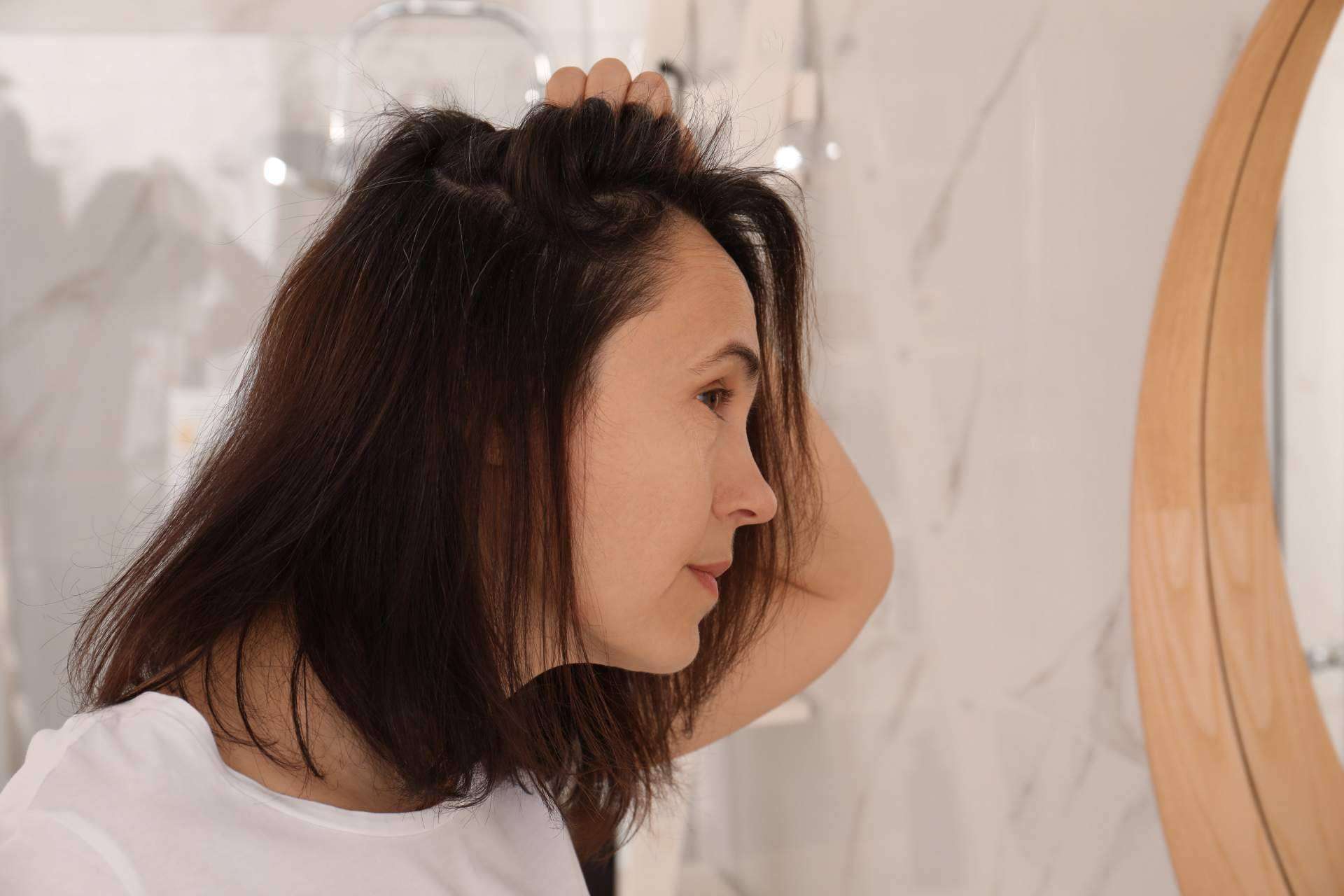 Las mujeres también pierden el pelo, por Clínica Femme