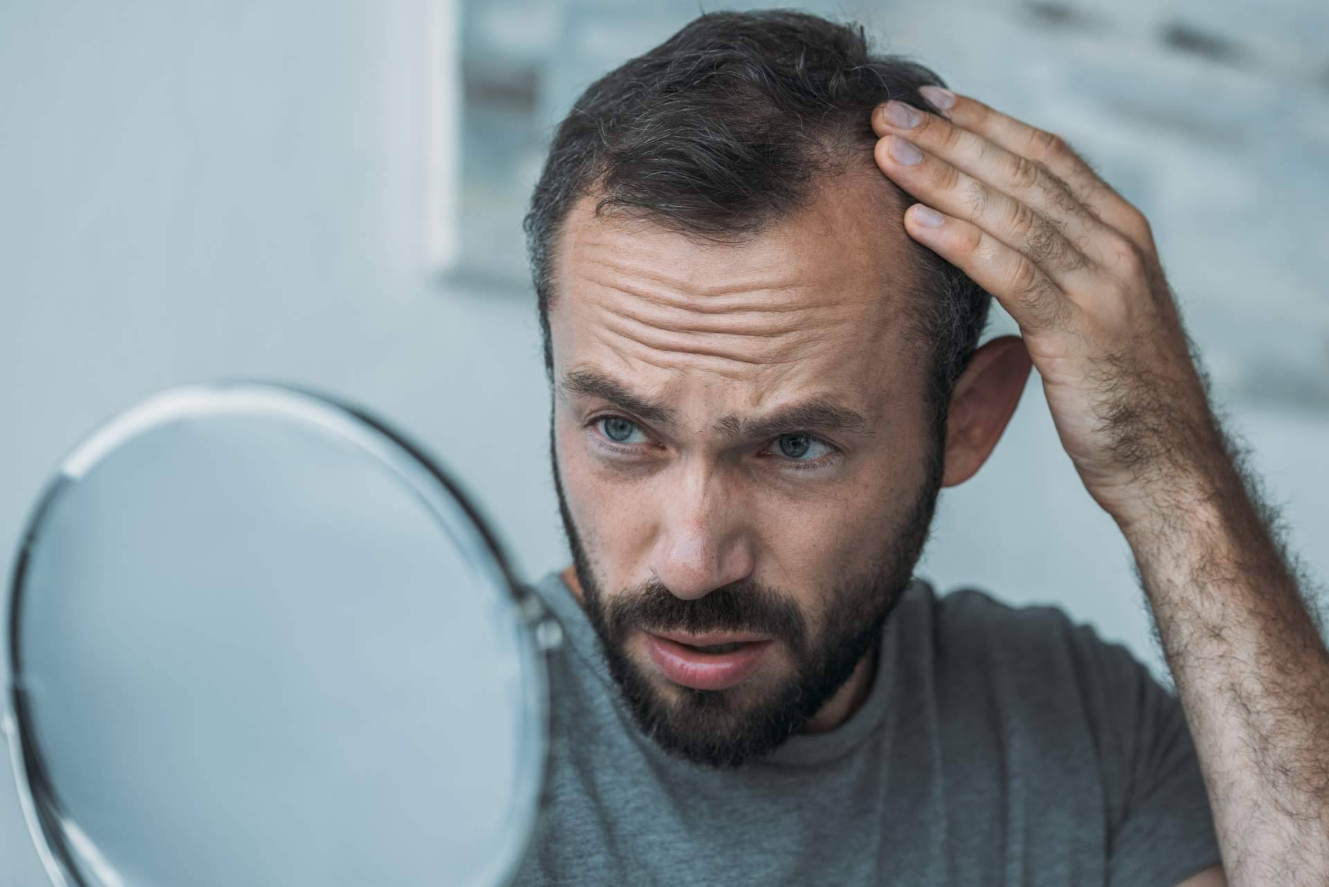 Tratar la alopecia androgénica con Saw Palmetto