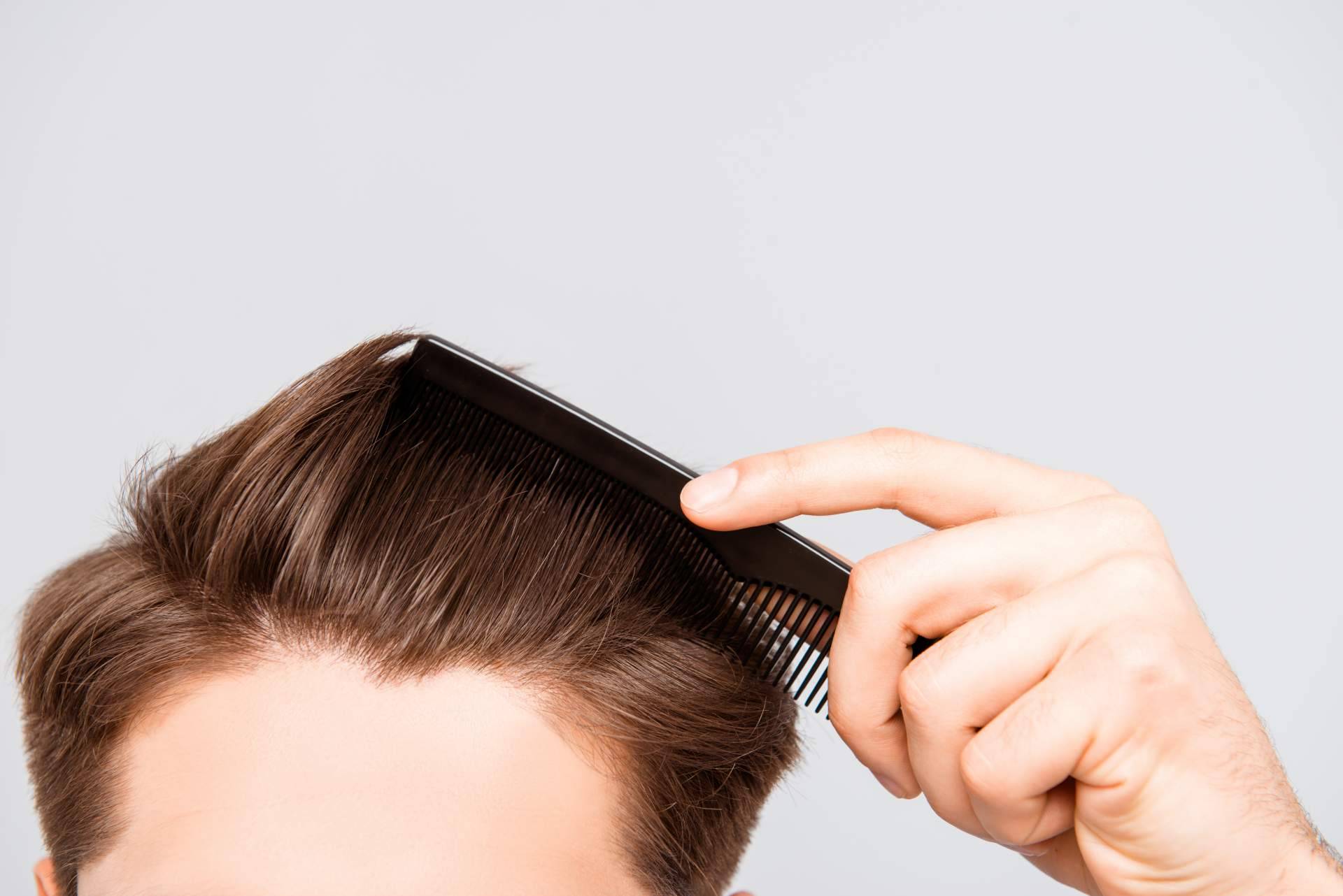 Nanofat, el tratamiento capilar de Clínica Tarrazo con el que es posible poner fin a la alopecia