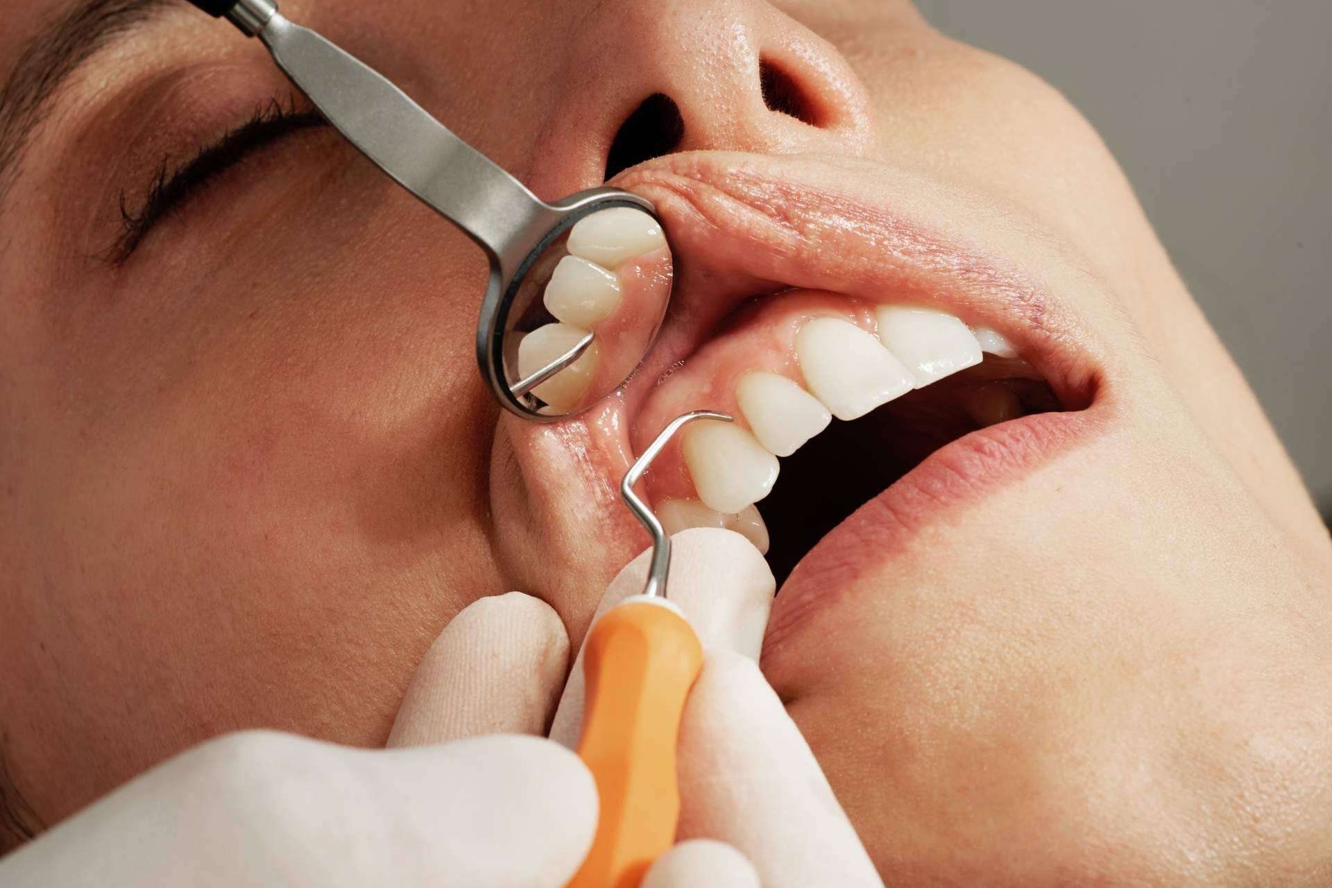 Clínica Sanzmar y su equipo especializado en periodoncia