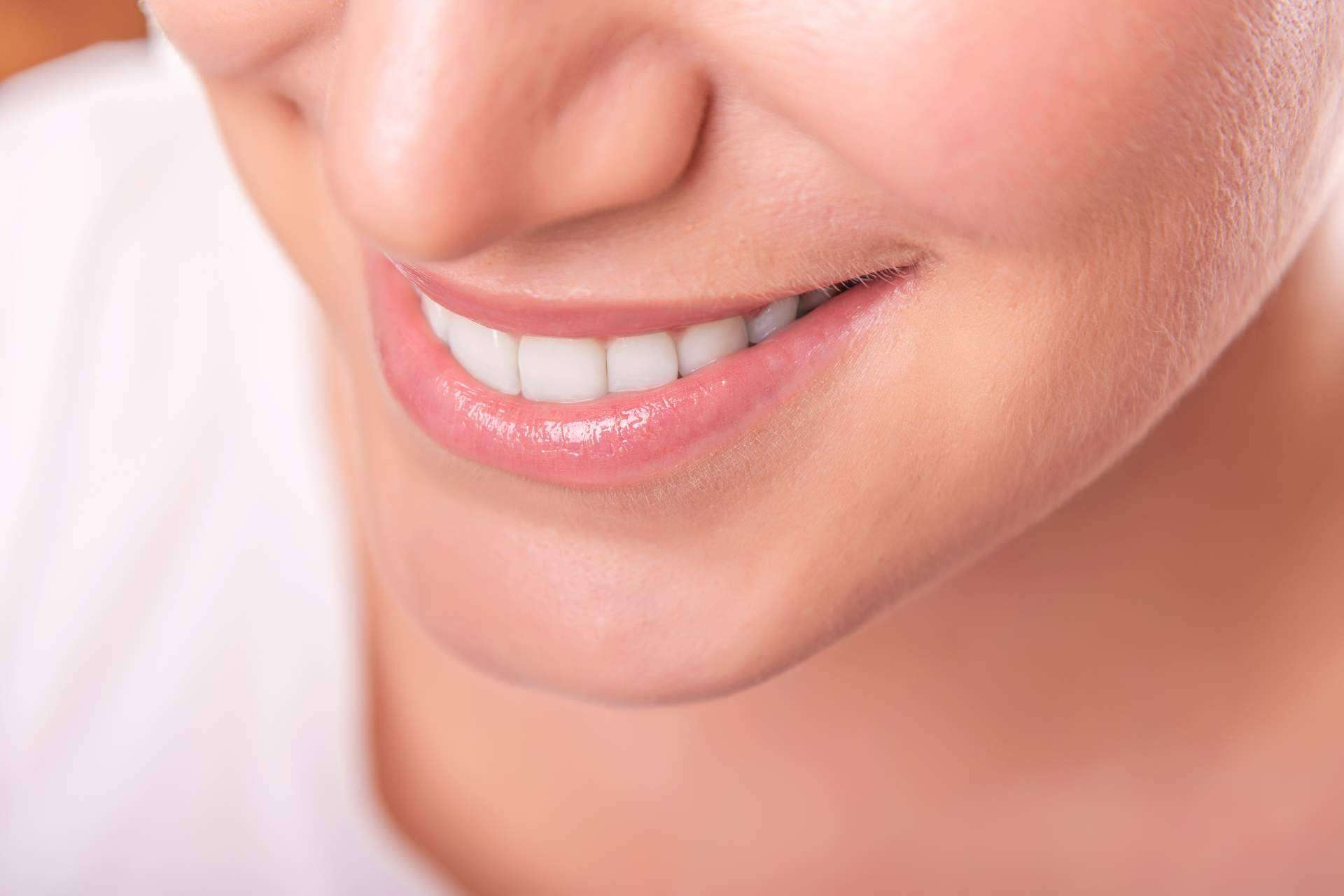 Corrales Dental realiza restauraciones estéticas a través de carillas de composite