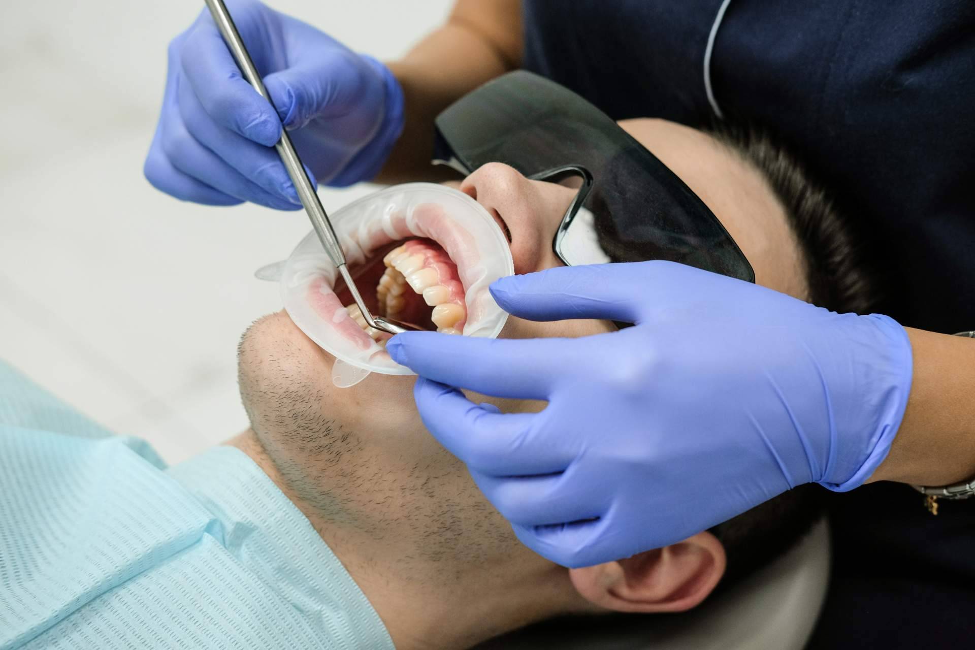 ¿Qué es y en qué consiste una endodoncia?, Implant Clinics resuelve todas las dudas