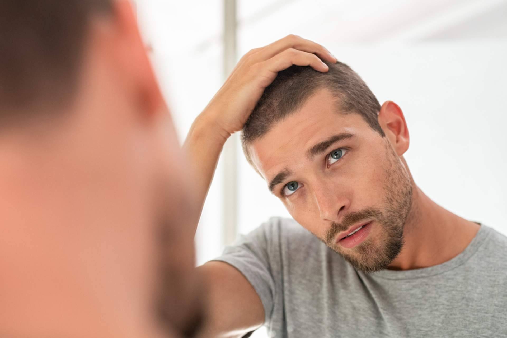 Xpecia Tablet, una alternativa para combatir la alopecia de la mano de Saw Palmetto