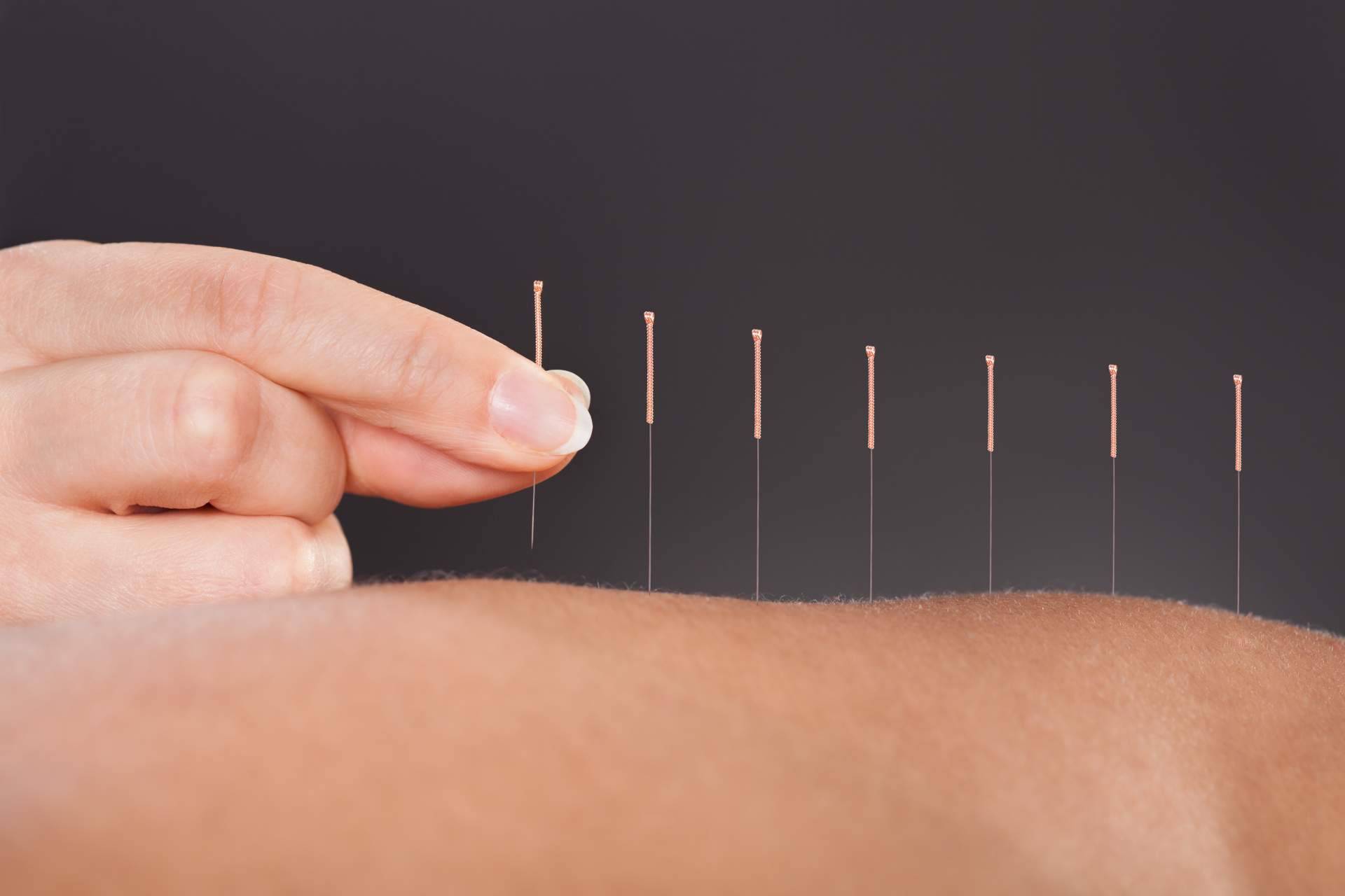 Trabajar de acupuntor y osteópata a través de una formación internacional profesional