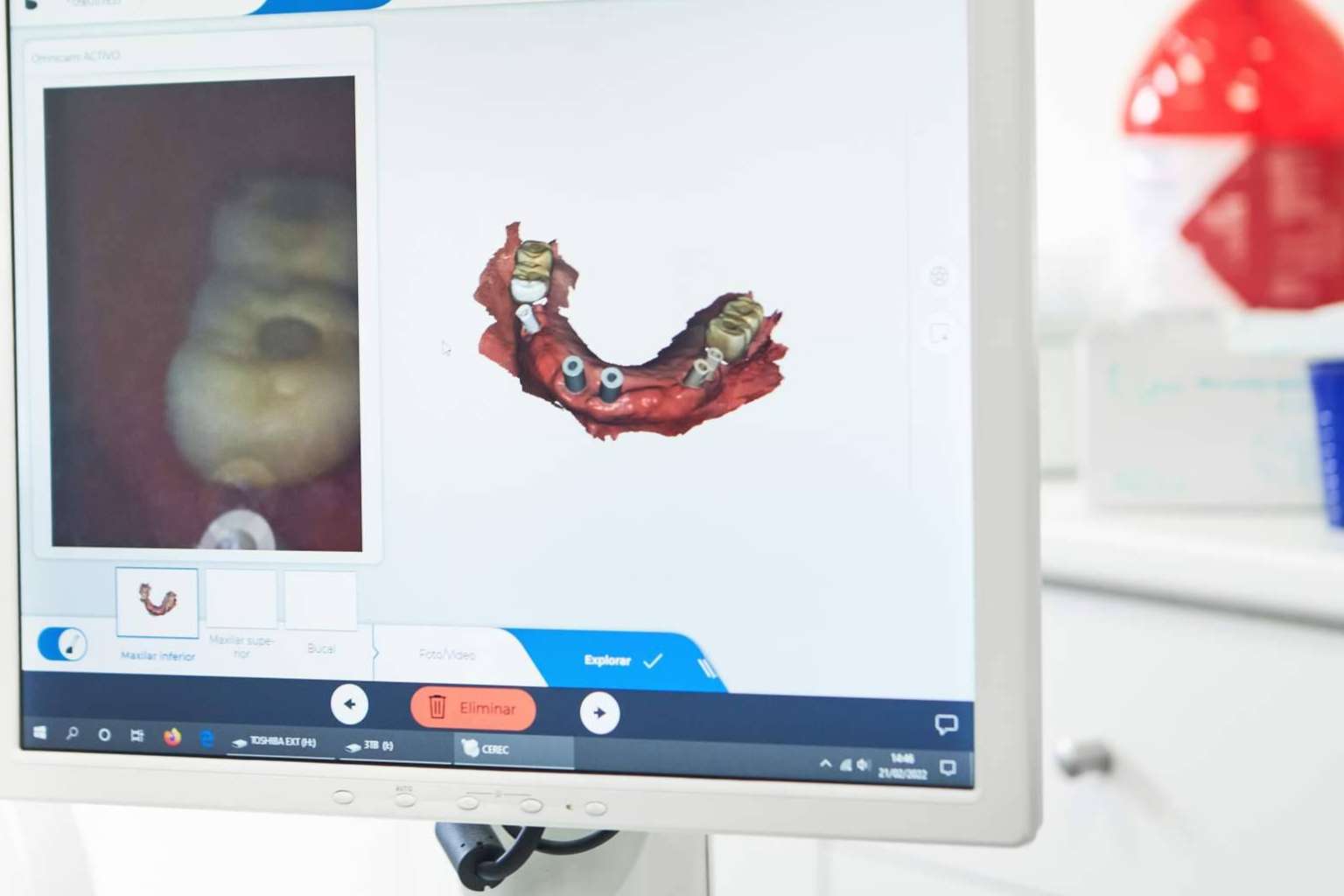 BORDONCLINIC garantiza técnicas de rehabilitación oral en un solo día