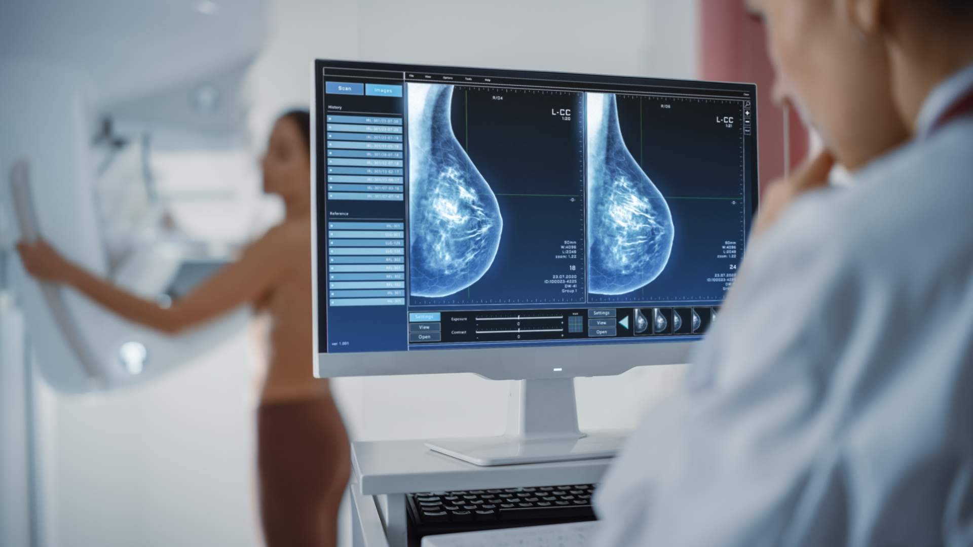 La oncología de precisión y la genotipia