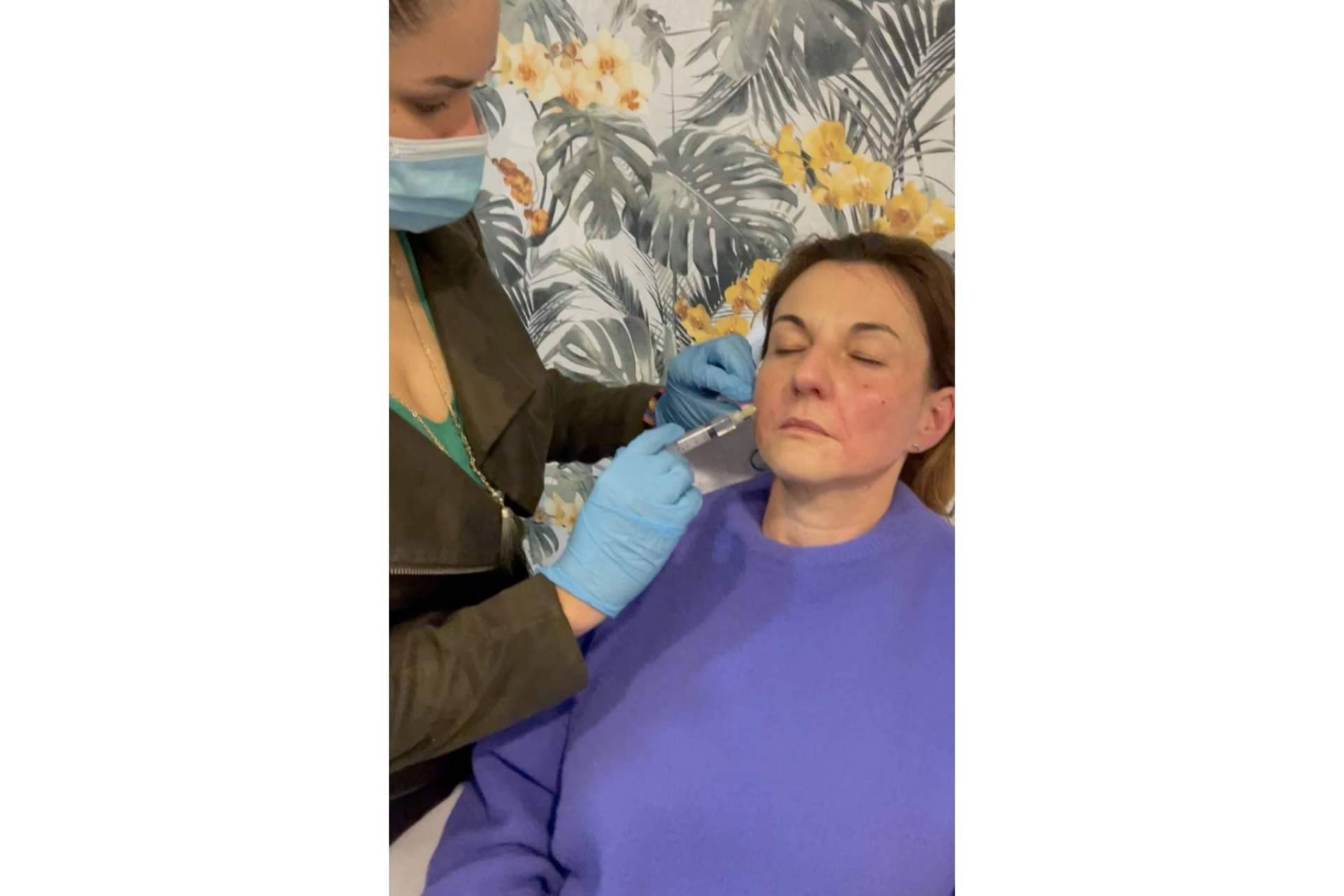 La importancia de renovar la piel después del verano