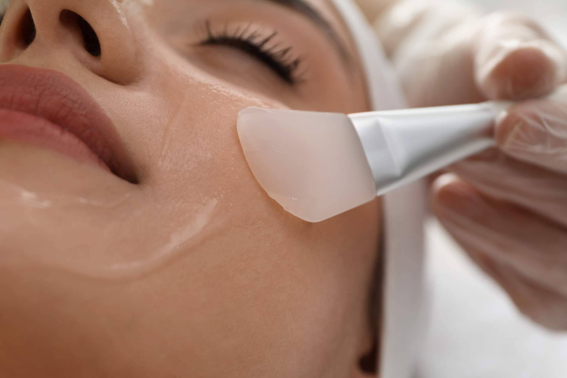 Peeling químico para lograr una piel saludable y luminosa, en Espacio Hebe