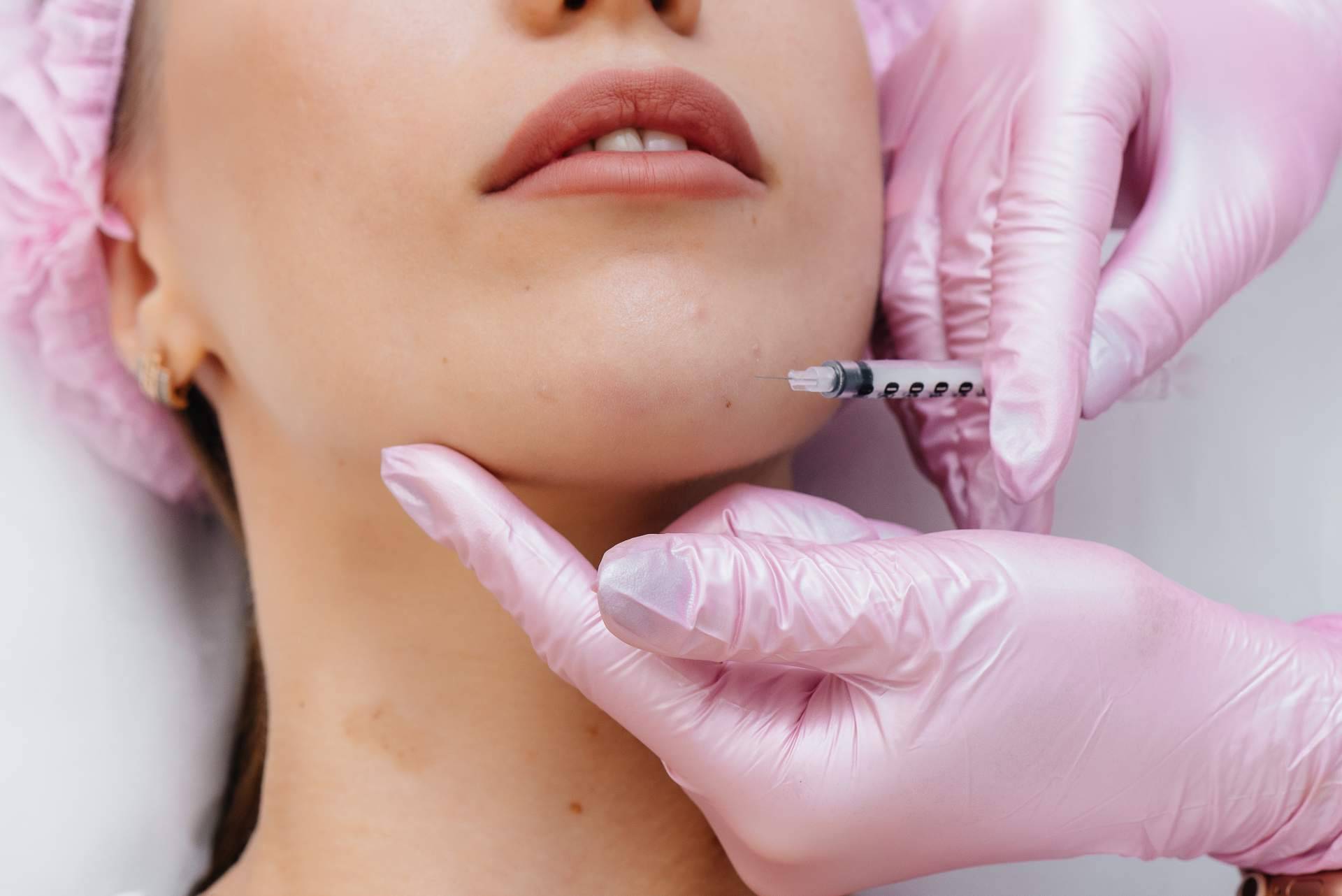 Aumento de mentón para dar una imagen facial diferente, de la mano del Dr. Jorge Planas