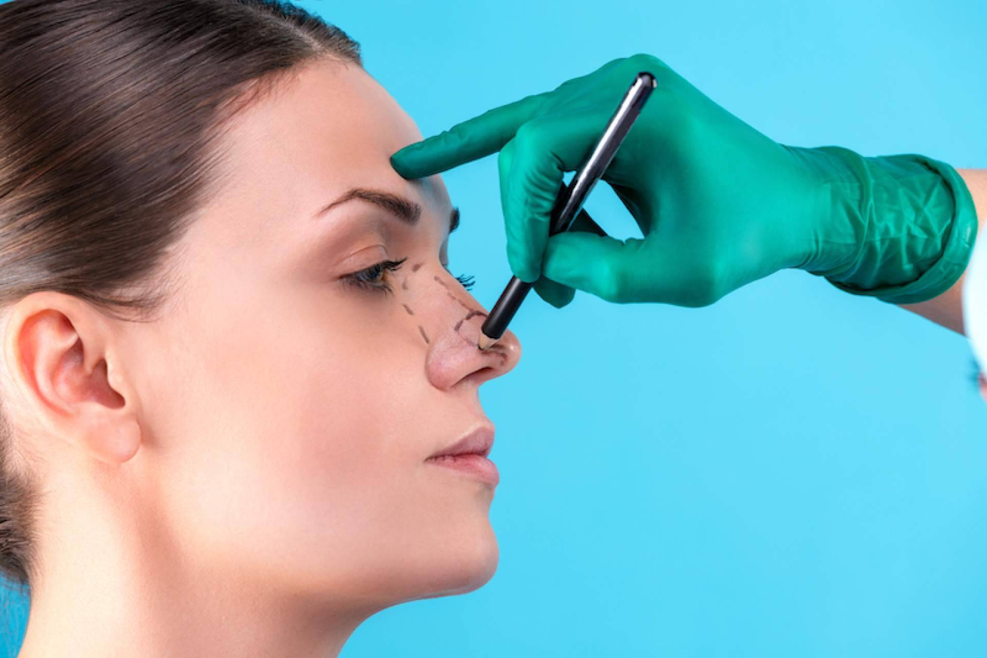 Clínica Dr. Millán Mateo, centro especializado en rinoplastia ultrasónica ubicado en Madrid