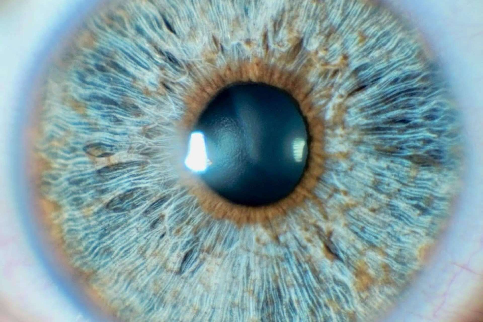 Los beneficios de la tecnología láser para cambiar el color de ojos