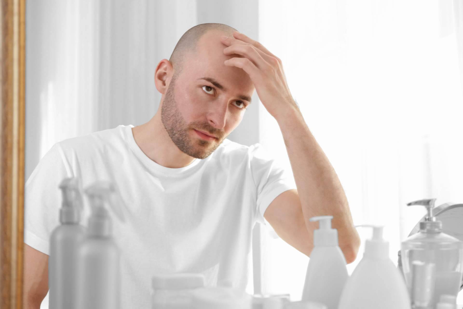 Cosmética natural para proteger la calvicie, de la mano de Machoman