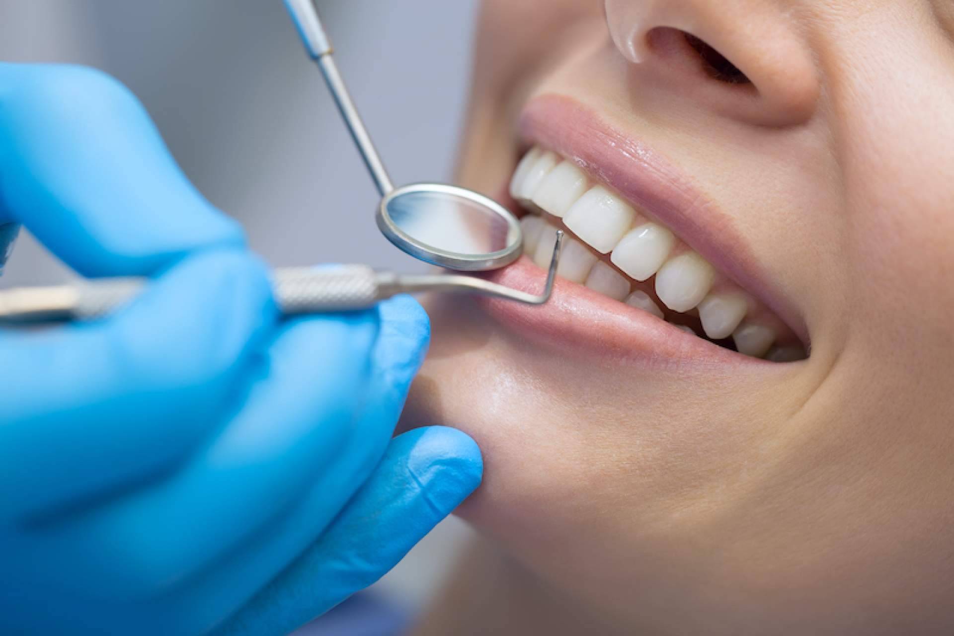 Cómo y dónde conseguir los dientes perfectos