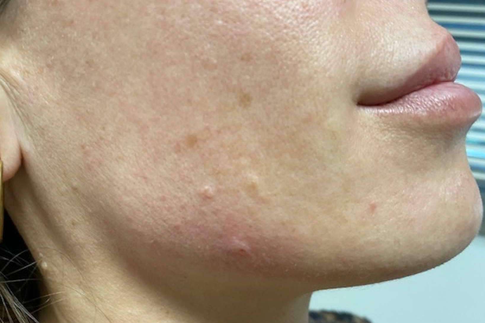 Clínica Amalfi y su tratamiento facial completo para mejorar el aspecto de la piel