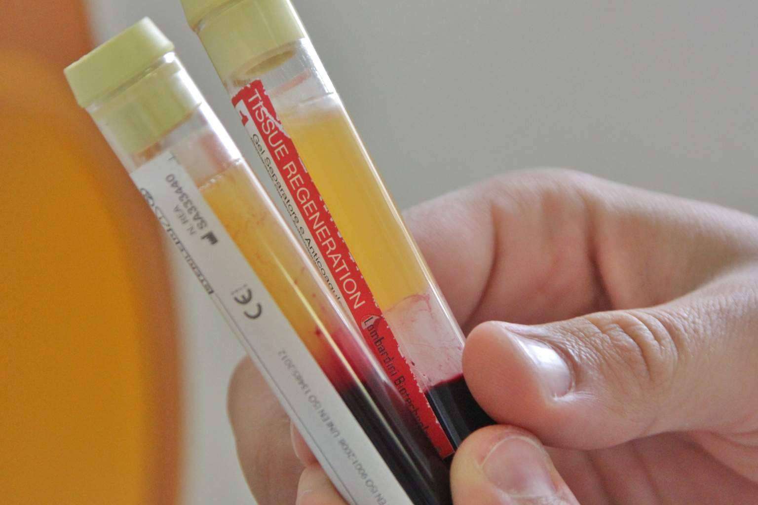 Volver a sonreír con salud es posible gracias al enfoque implantosofista de Clinica Biorigenera