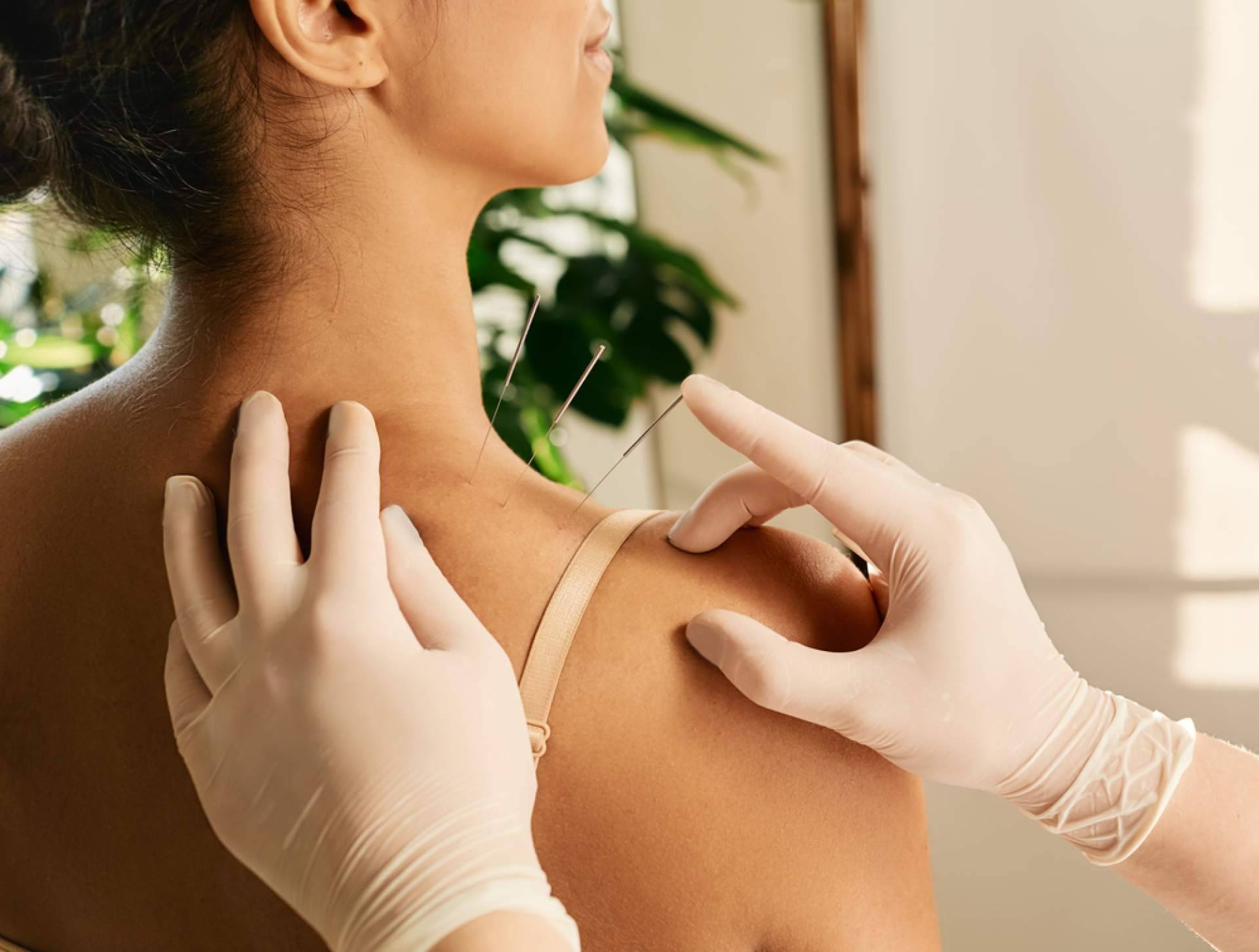 Shenti Wellness afirma que la acupuntura tiene múltiples beneficios para la fertilidad