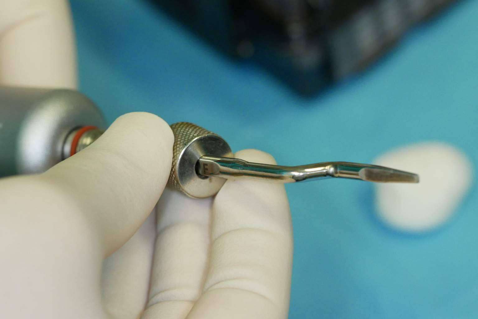 Clínica Biorigenera, especialistas en recuperar la sonrisa y la salud bucodental con implantes dentales cerámicos