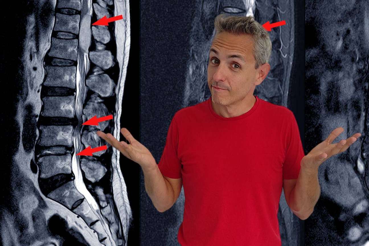 Roberto Galván destaca el enfoque más eficaz para el tratamiento de la hernia discal L5-S1