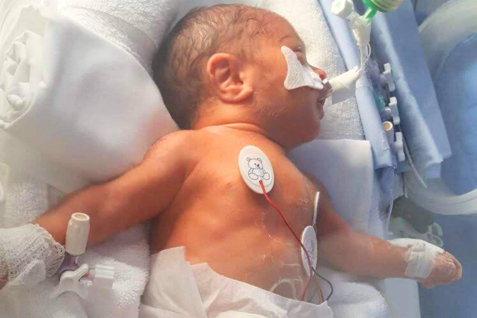 Cuando la vida se adelanta, el viaje invisible de las familias de bebés prematuros